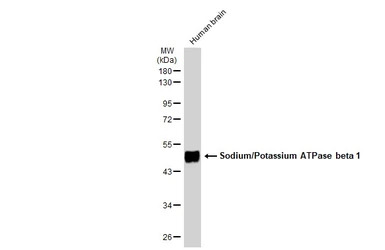 Sodium/Potassium ATPase beta 1