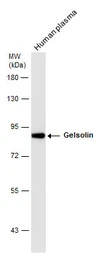 Gelsolin antibody