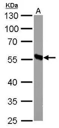 DBT antibody