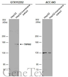 TRPM2 antibody [N1N2-2], N-ter