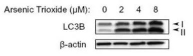 LC3B antibody