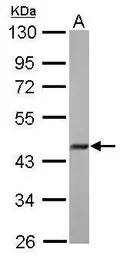 FBXO22 antibody [N3C3]