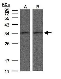 PPP4C antibody [N1], N-term