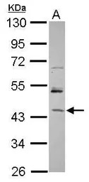 RBM17 antibody [N3C3]