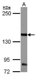 IL3 Receptor beta antibody [N1
