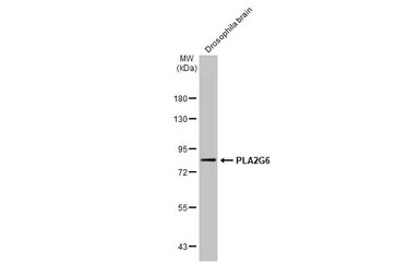 PLA2G6 antibody [N3C3]