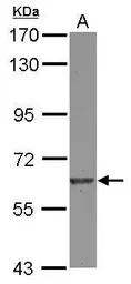 EIF2B delta antibody