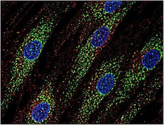 CD63 antibody [MEM-259]