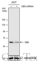 CBS antibody