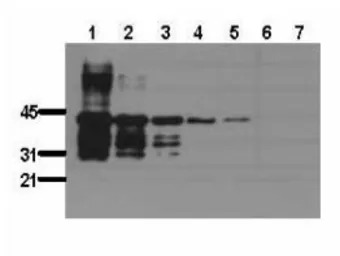GST tag antibody [BDI340]