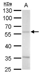 ADC antibody [N2C2], Internal