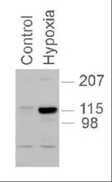 HIF2 alpha antibody