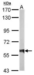 Rhotekin antibody