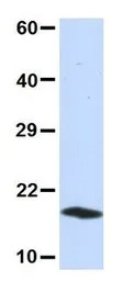 UBE2D3 antibody, N-term