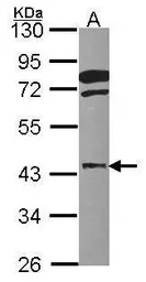 FGFR1OP antibody [N1C2]