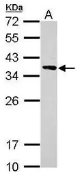 Calponin 2 antibody