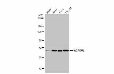 ACADVL antibody [N1C1]