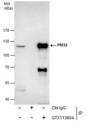 PMS2 antibody [N1N3]