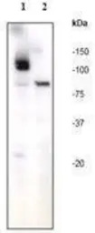 PARP (p116/p85) antibody [E78]
