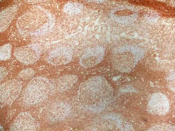 CD4 antibody [RPA-T4] (Low end