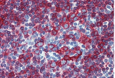 HLA-DR + HLA-DP antibody [HL-3