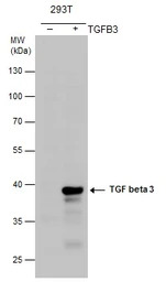 TGF beta 3 antibody [N1C1]