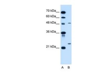 SMPD2 antibody, N-term