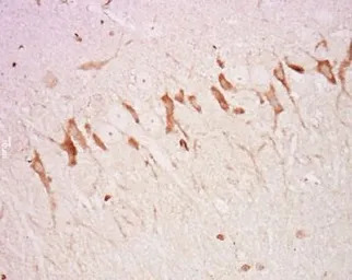 Neurofascin 155 antibody