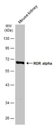 ROR alpha antibody [C3], C-ter