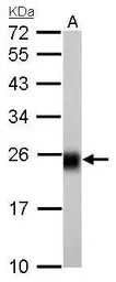 NDUFS8 antibody