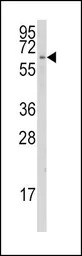 CYP1A1 antibody, C-term