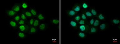 MTA1 antibody [C1C3]