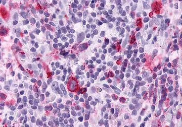 Leukotriene B4 Receptor antibo