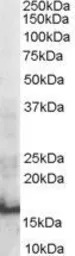 SH2D1A antibody, Internal
