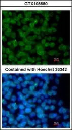 ZNF198 antibody