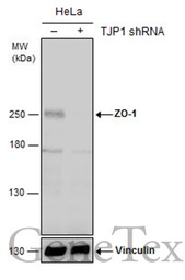 ZO-1 antibody
