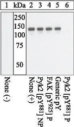PYK2 (phospho Tyr881) antibody