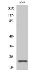 PARP (cleaved Asp214) antibody