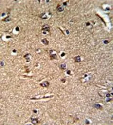 GGT5 antibody, N-term