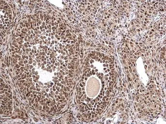 MTA1 antibody [C1C3]