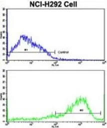 Interferon gamma Receptor 2 an