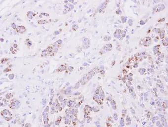 15-PGDH antibody [C2C3], C-ter