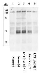 LAT (phospho Tyr132) antibody