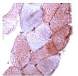 Dysferlin antibody (Ready-to-u