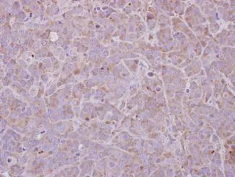 MAGEB1 antibody