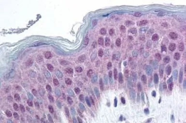 HMG14 (phospho Ser20/Ser24) an