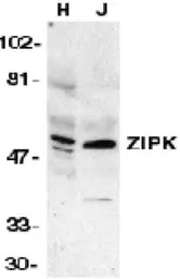 DAP Kinase 3 antibody