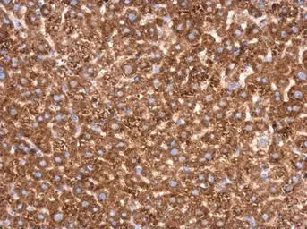 Transketolase antibody [N3C2],