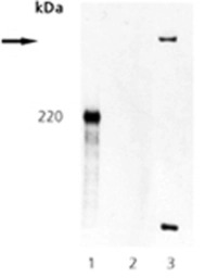 ATM (phospho Ser1981) antibody