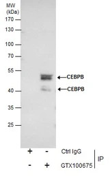 C/EBP beta antibody